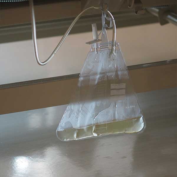 İdrar sondası hizmeti